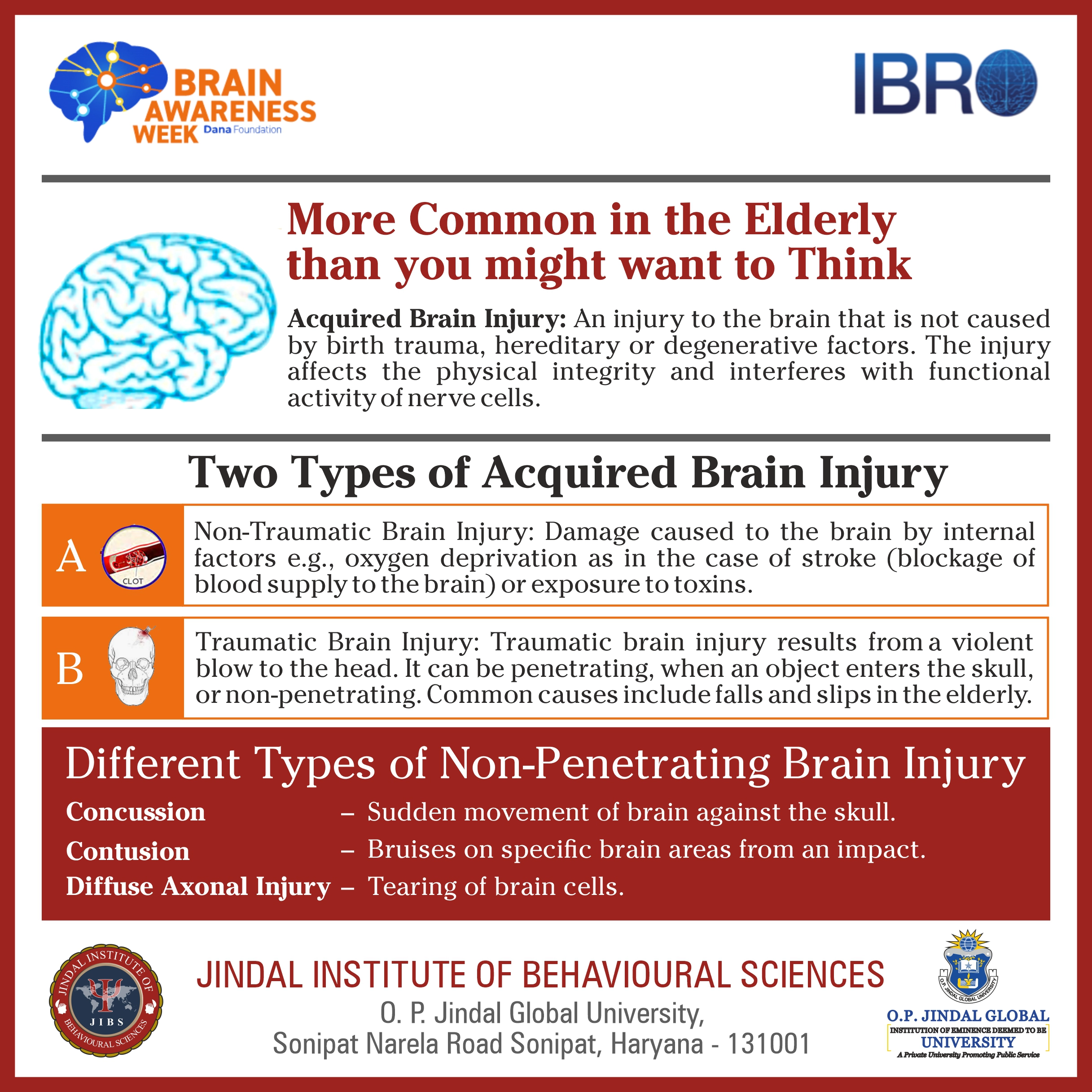 Poster 6 - Brain Awareness Week 2022 copy
